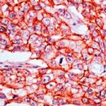 beta Catenin Antibody in Immunohistochemistry (Paraffin) (IHC (P))