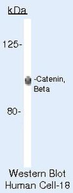 beta Catenin Antibody in Western Blot (WB)