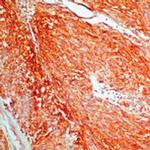 c-Kit Antibody in Immunohistochemistry (Paraffin) (IHC (P))