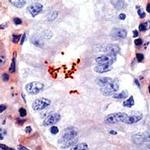 Helicobacter pylori Antibody in Immunohistochemistry (IHC)