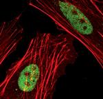 SKP2 Antibody in Immunocytochemistry (ICC/IF)