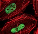 TDP-43 Antibody in Immunocytochemistry (ICC/IF)