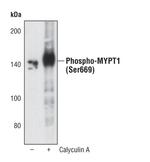 Phospho-MYPT1 (Ser668) Antibody in Western Blot (WB)