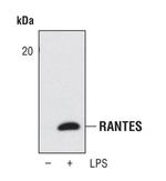 CCL5 (RANTES) Antibody in Western Blot (WB)