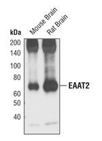 GLT-1 Antibody in Western Blot (WB)