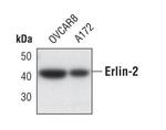 ERLIN2 Antibody in Western Blot (WB)