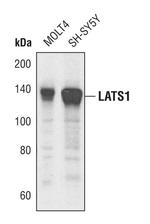 LATS1 Antibody in Western Blot (WB)