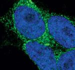 STIM2 Antibody in Immunocytochemistry (ICC/IF)