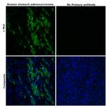 c-Met Antibody in Immunohistochemistry (Paraffin) (IHC (P))