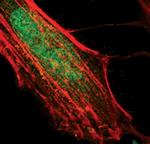 WDR77 Antibody in Immunocytochemistry (ICC/IF)