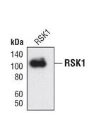 RSK1 Antibody in Western Blot (WB)