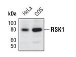 RSK1 Antibody in Western Blot (WB)