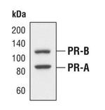 Progesterone Receptor Antibody in Western Blot (WB)