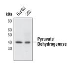 PDHA1/PDHA2 Antibody in Western Blot (WB)