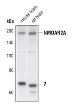 NMDAR2A Antibody in Western Blot (WB)