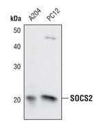 SOCS2 Antibody in Western Blot (WB)