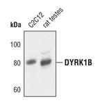 DYRK1B Antibody in Western Blot (WB)