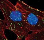 ITGB5 Antibody in Immunocytochemistry (ICC/IF)