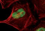 JunB Antibody in Immunocytochemistry (ICC/IF)