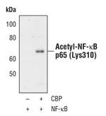 Acetyl-NFkB p65 (Lys310) Antibody in Western Blot (WB)