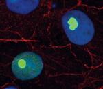 RPL7A Antibody in Immunocytochemistry (ICC/IF)