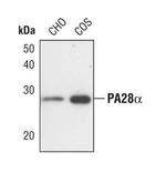 PSME1 Antibody in Western Blot (WB)