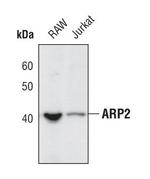 Arp2 Antibody in Western Blot (WB)