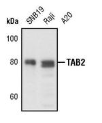 TAB2 Antibody in Western Blot (WB)