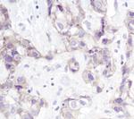 gamma Catenin Antibody in Immunohistochemistry (Paraffin) (IHC (P))