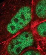 AP2 gamma Antibody in Immunocytochemistry (ICC/IF)