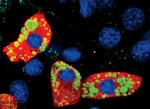 SCD Antibody in Immunocytochemistry (ICC/IF)