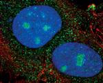 PSME2 Antibody in Immunocytochemistry (ICC/IF)