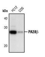 PSME2 Antibody in Western Blot (WB)