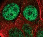 PSME3 Antibody in Immunocytochemistry (ICC/IF)