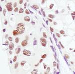 PSME3 Antibody in Immunohistochemistry (Paraffin) (IHC (P))