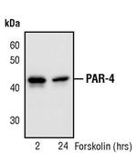 Phospho-PAR4 (Thr163) Antibody in Western Blot (WB)