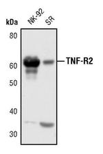 TNFR2 Antibody in Western Blot (WB)