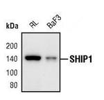 SHIP1 Antibody in Western Blot (WB)