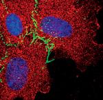 VE-cadherin Antibody in Immunocytochemistry (ICC/IF)