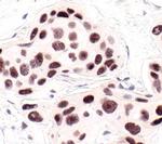 HP1 alpha Antibody in Immunohistochemistry (Paraffin) (IHC (P))