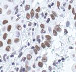 Ku80 Antibody in Immunohistochemistry (Paraffin) (IHC (P))