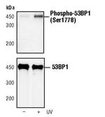 Phospho-53BP1 (Ser1778) Antibody