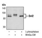 DVL2 Antibody in Western Blot (WB)