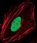 SKP2 Antibody in Immunocytochemistry (ICC/IF)