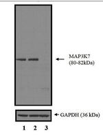 TAK1 Antibody