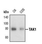 TAK1 Antibody in Western Blot (WB)