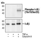 Phospho-IkB beta (Thr19, Ser23) Antibody in Western Blot (WB)