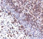 LAT Antibody in Immunohistochemistry (IHC)