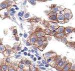 N-cadherin Antibody in Immunohistochemistry (Paraffin) (IHC (P))