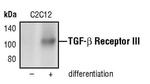 TGFBR3 Antibody in Western Blot (WB)